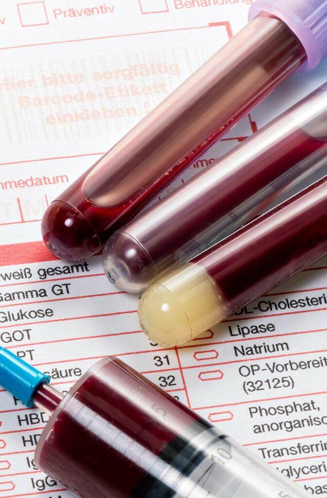 Blood collection tubes and a syringe lying on a laboratory requisition form